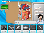 juegos de cirugia de corazon